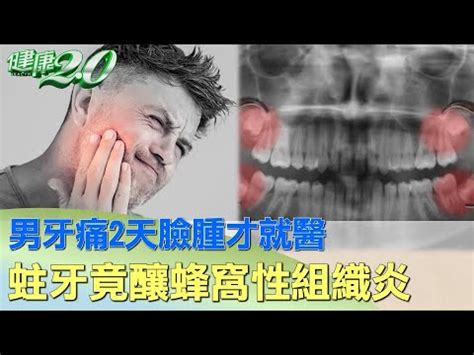 雞跟猴合嗎 牙痛臉腫怎麼消